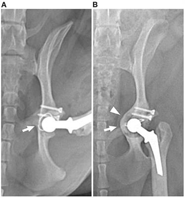 Case report: Three-dimensionally printed patient-specific acetabular cage for revision surgery of aseptic loosening in a dog with micro total hip replacement